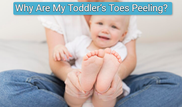 Why Are My Toddler’s Toes Peeling?